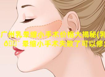 广州乳晕缩小手术价格大揭秘(乳 🌴 晕缩小手术失败了可以修复吗)